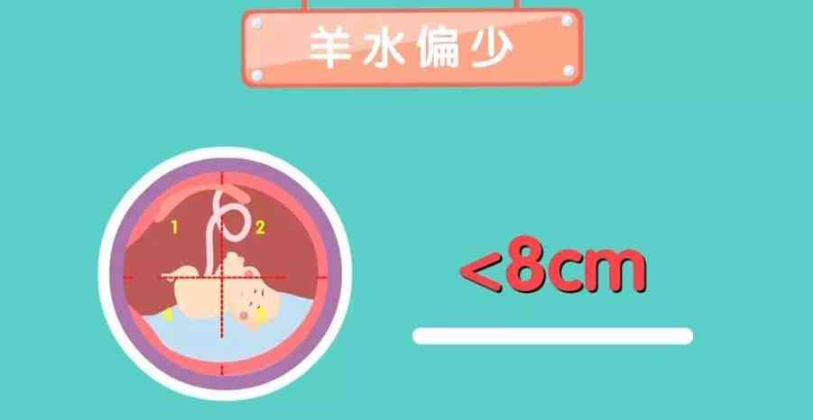 37加3羊水深度125羊水过多怎么办-孕妇羊水深度过多怎么办？三个关键步骤教你轻松化解危机