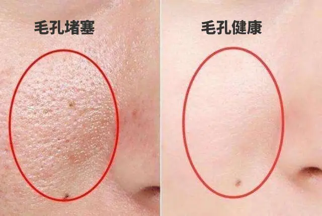 天婷排油王_泰尔排油王效果评价_泰尔p57排油王的危害