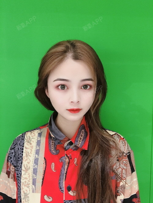 大v线提升后嘴巴歪了_面部提升嘴巴歪了_大v线提升面部好吗