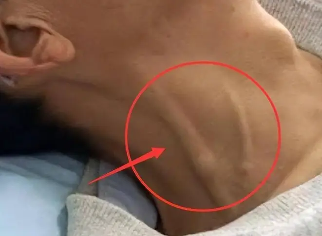 残气量与功能残气量的区别_功能残气量是由什么决定的_残气量和功能残气量名词解释